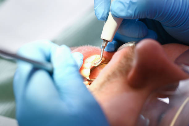 Best Emergency Dentist for Lost Fillings or Crowns in Stokesdale, NC
